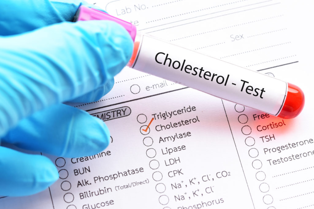 cholesterol test cholesterol test